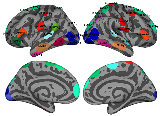 Neural Basis of Phonological Acceptability Judgments